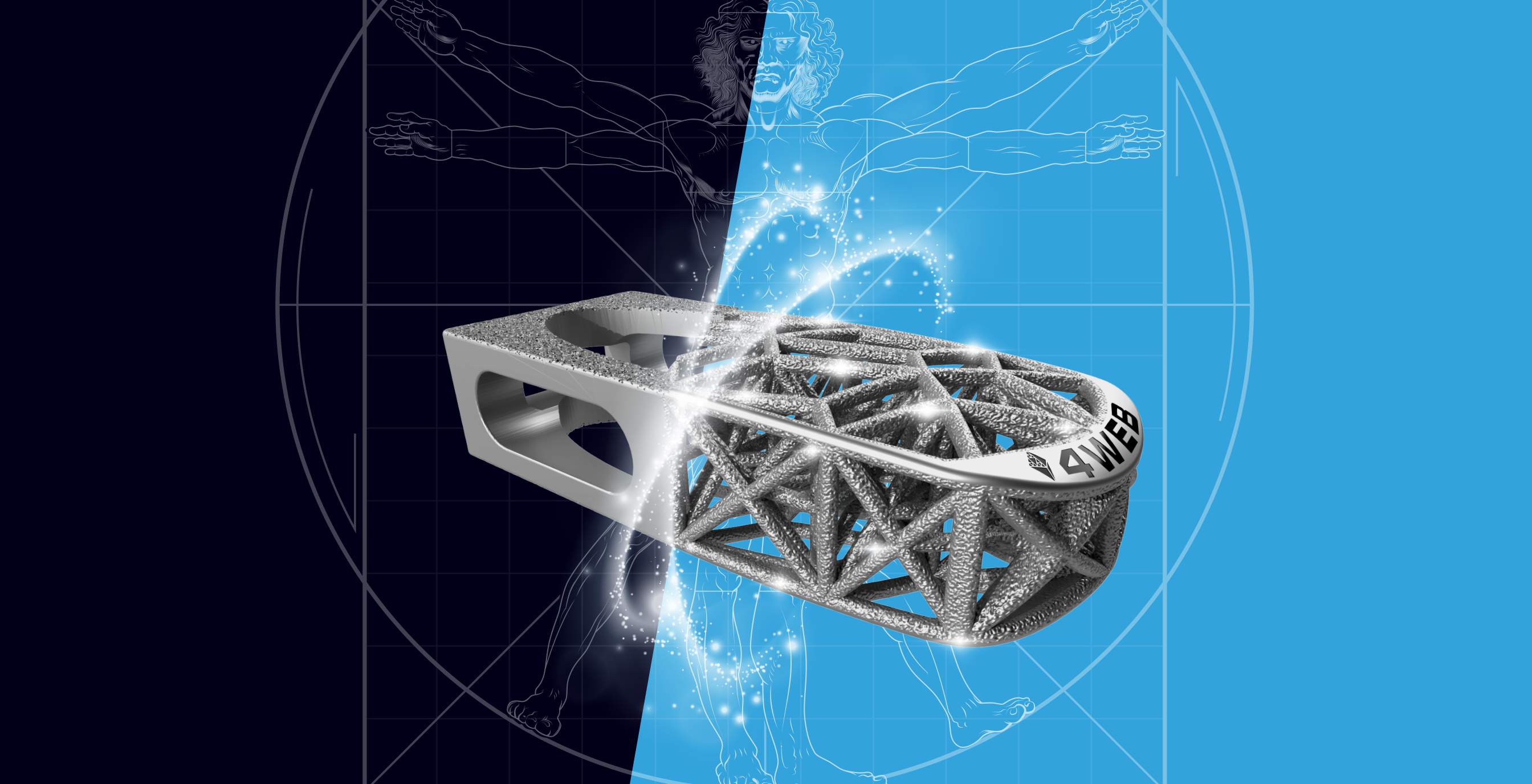 4WEB Truss Implant Technology