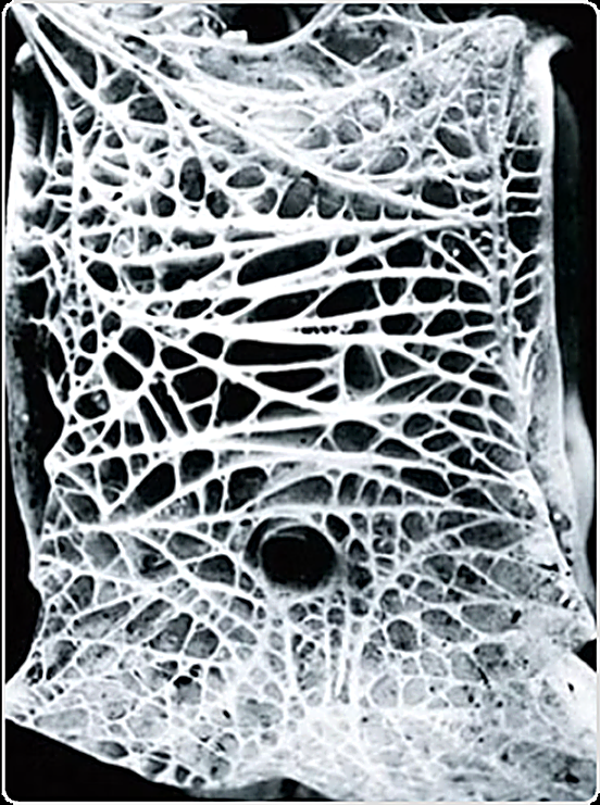 Microscopic image of trabecular bone's natural lattice structure