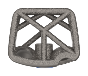 CSTS-SA with Anchor Fixation top view