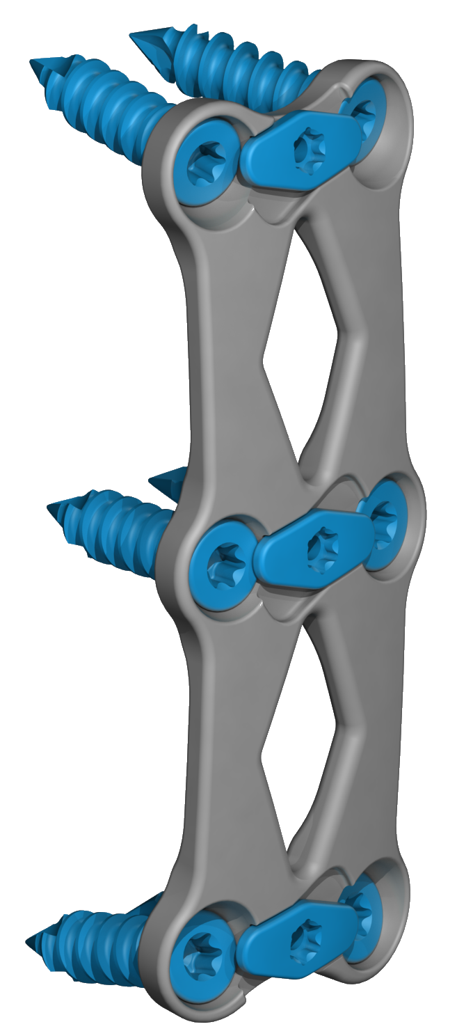 Cervical Spine Plating Solution