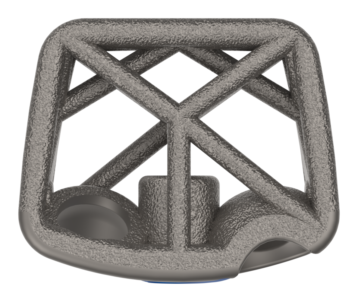 Cervical Spine Truss System – Stand Alone, top view