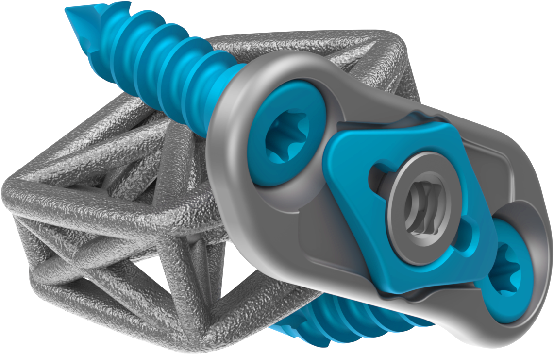 Cervical Spine Truss System™ 2.0 – Integrated Plate