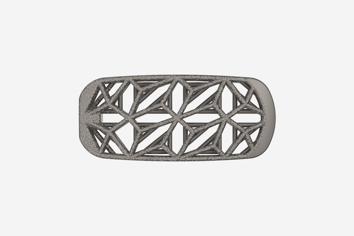 Lateral Spine Truss System top view