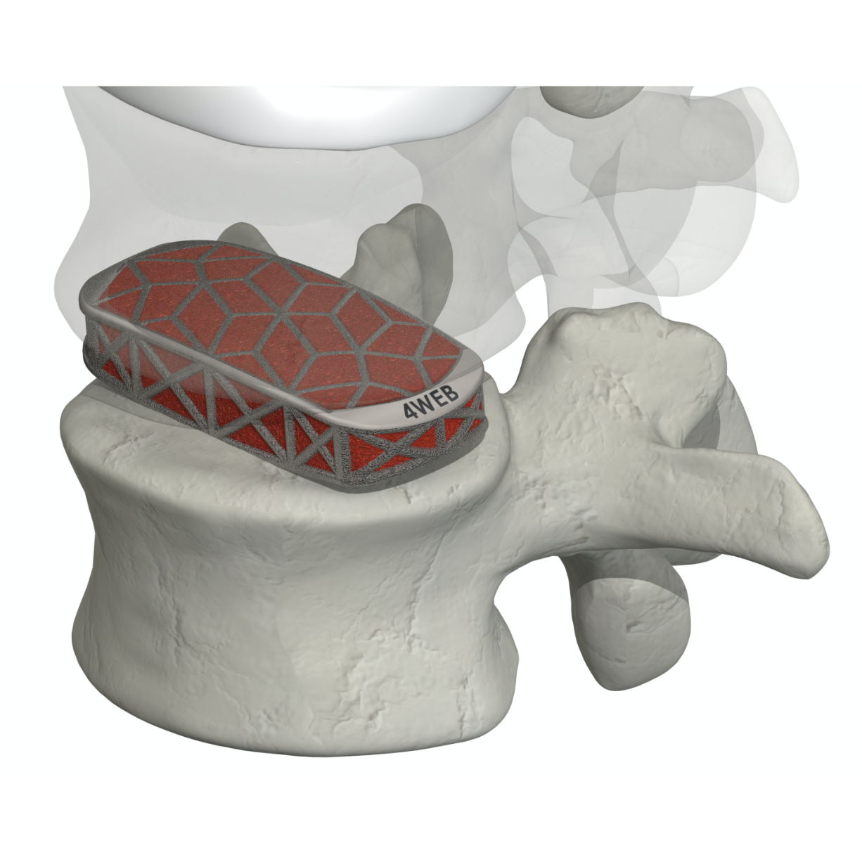 LSTS placed within the lumbar spine