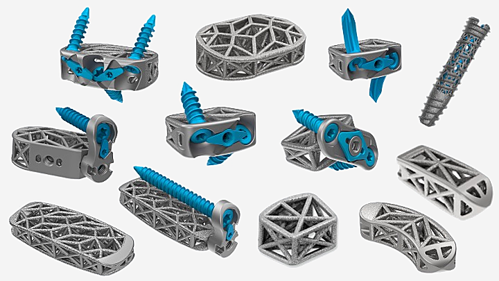 4WEB truss implant family
